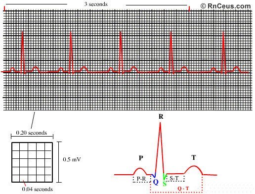How to read ECG paper